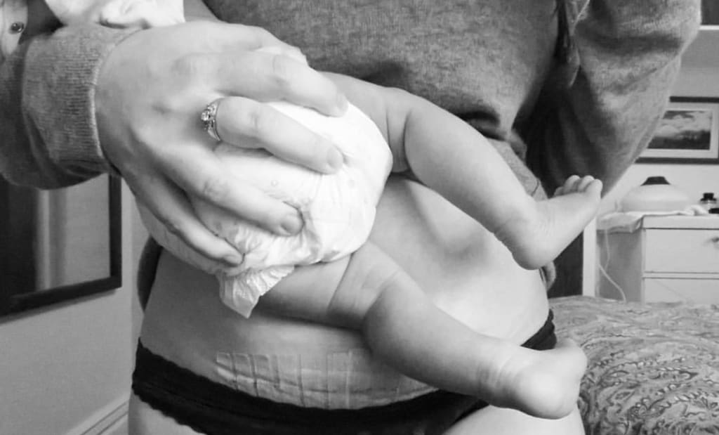 The Day I Became Infertile The Day I Became Infertile