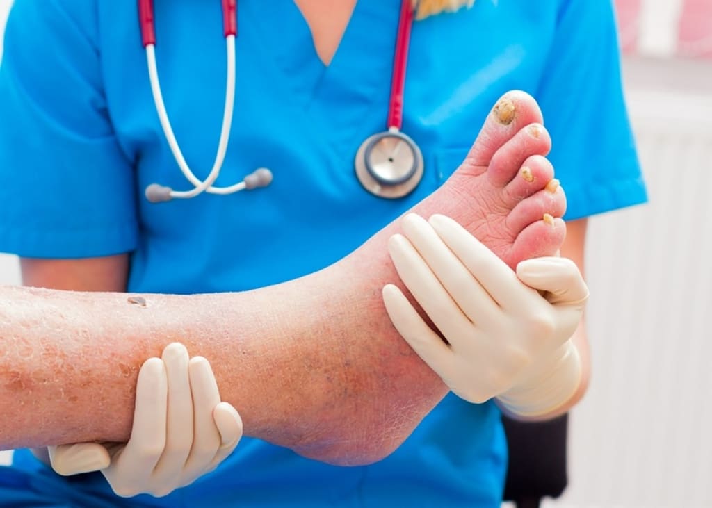 Get Your Custom Orthotics Today And Strengthen Your Steps! Get Your Custom Orthotics Today And Strengthen Your Steps!
