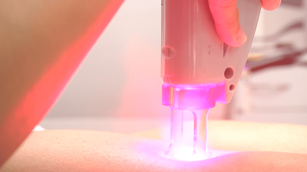 Everything You Need To Know About Hair Removal At Home Everything You Need To Know About Hair Removal At Home