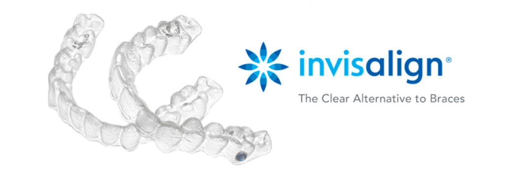 Reasons Why You Should Get Invisalign Braces in Abu Dhabi Reasons Why You Should Get Invisalign Braces in Abu Dhabi