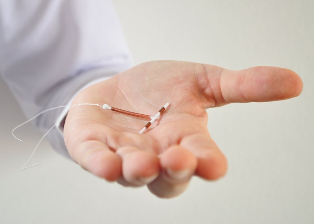 What it's like: IUCD (Contraceptive Device) What it's like: IUCD (Contraceptive Device)