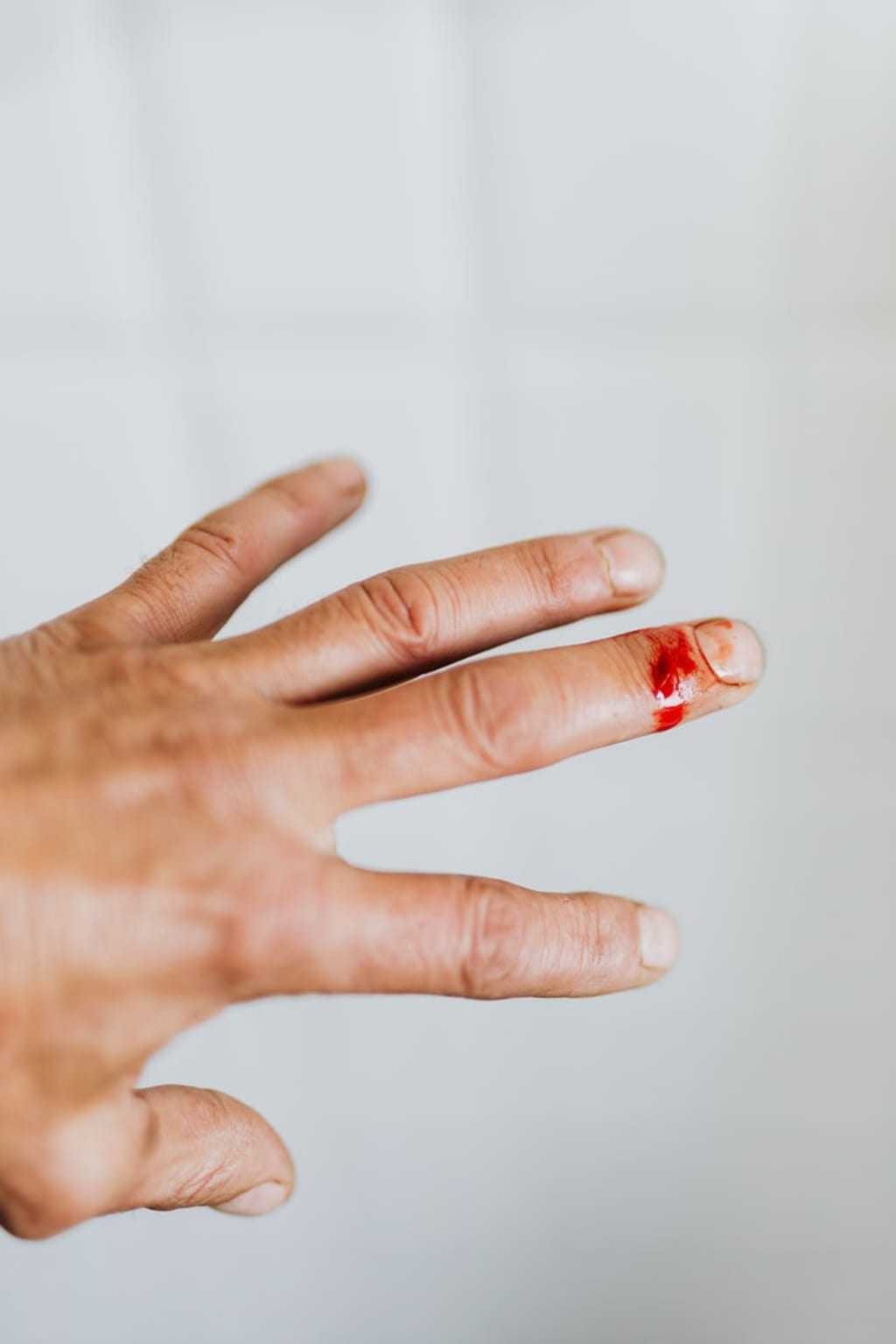 How to clean wounds safely for proper healing? How to clean wounds safely for proper healing?