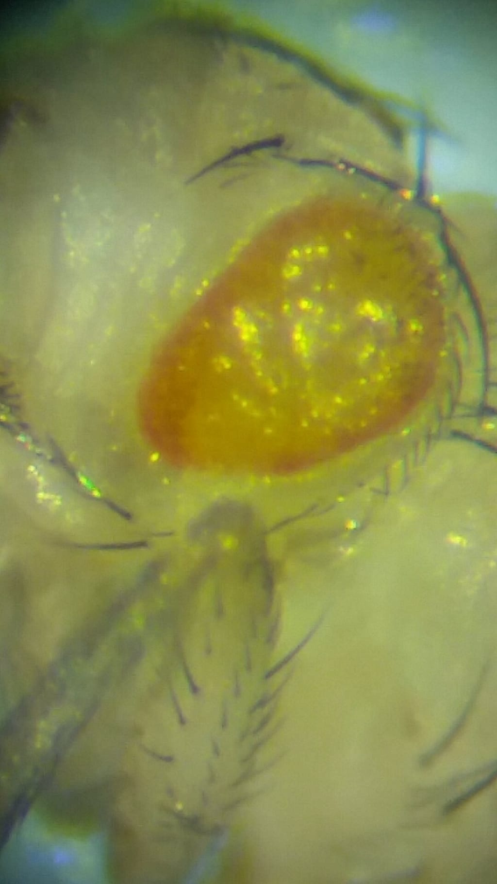 The Effects of Garlic Powder on Drosophila Flies with Tumors The Effects of Garlic Powder on Drosophila Flies with Tumors