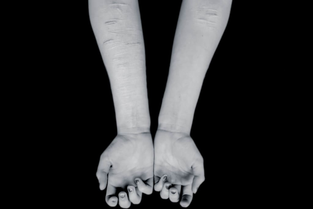 Mental Illness As a Scapegoat Mental Illness As a Scapegoat