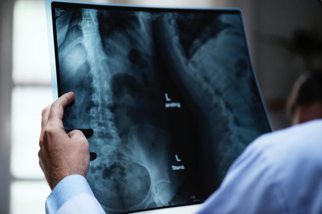 radiation exposure x ray radiation exposure x ray