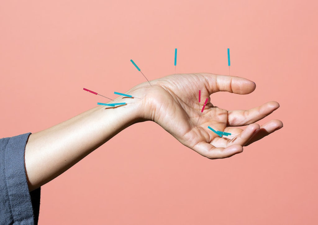 Exploring Acupuncture Longevity