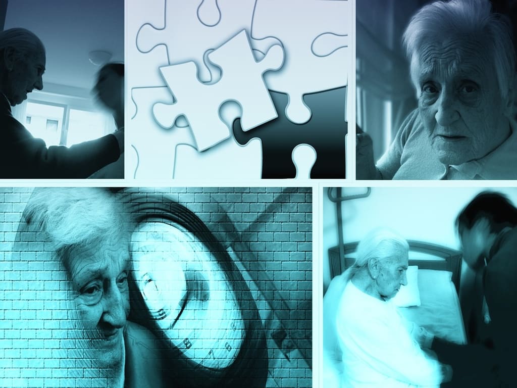 Is There a Test for Dementia? Is There a Test for Dementia?