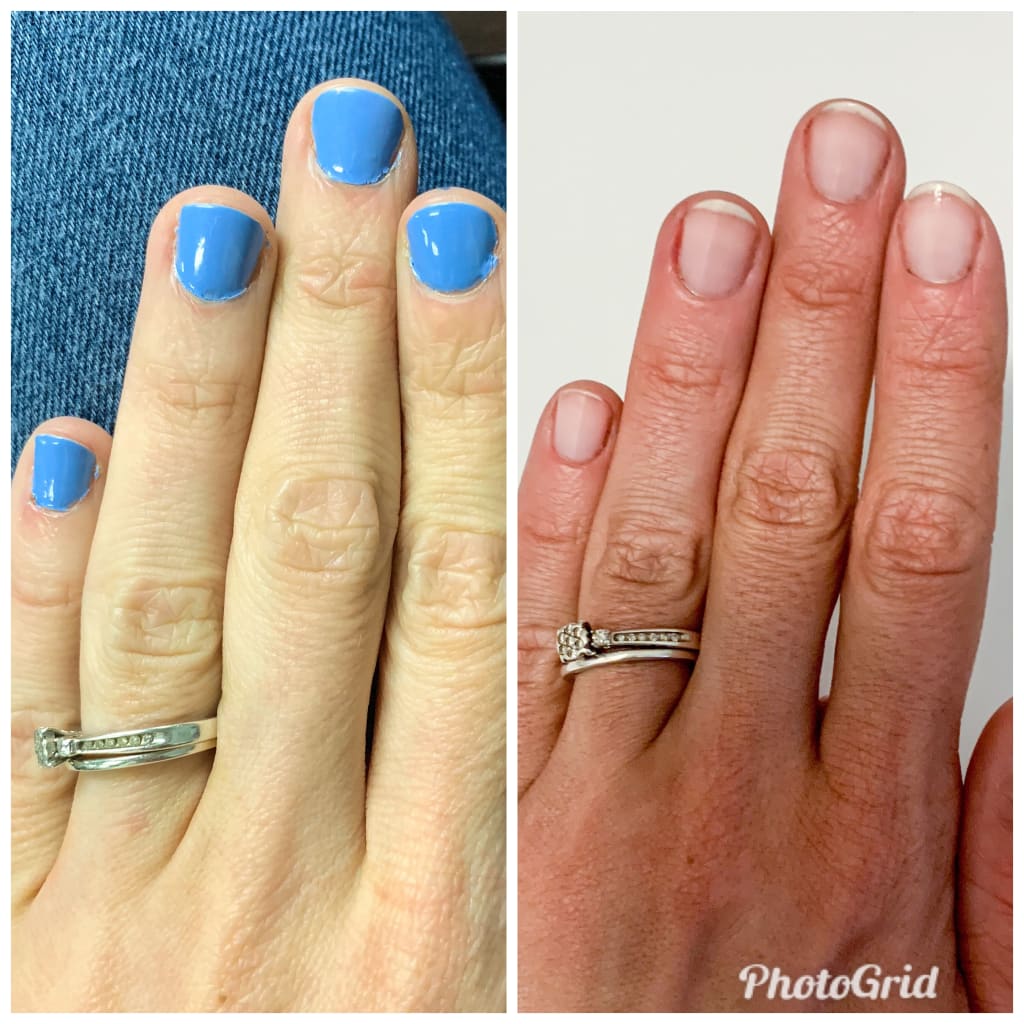 Is It in the Genes, or Does Your Nail Care Routine Need Help? Is It in the Genes, or Does Your Nail Care Routine Need Help?