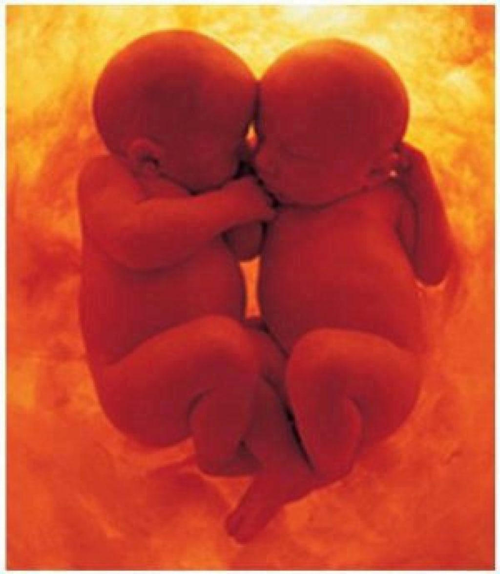 To The Baby Who Was To The Baby Who Was