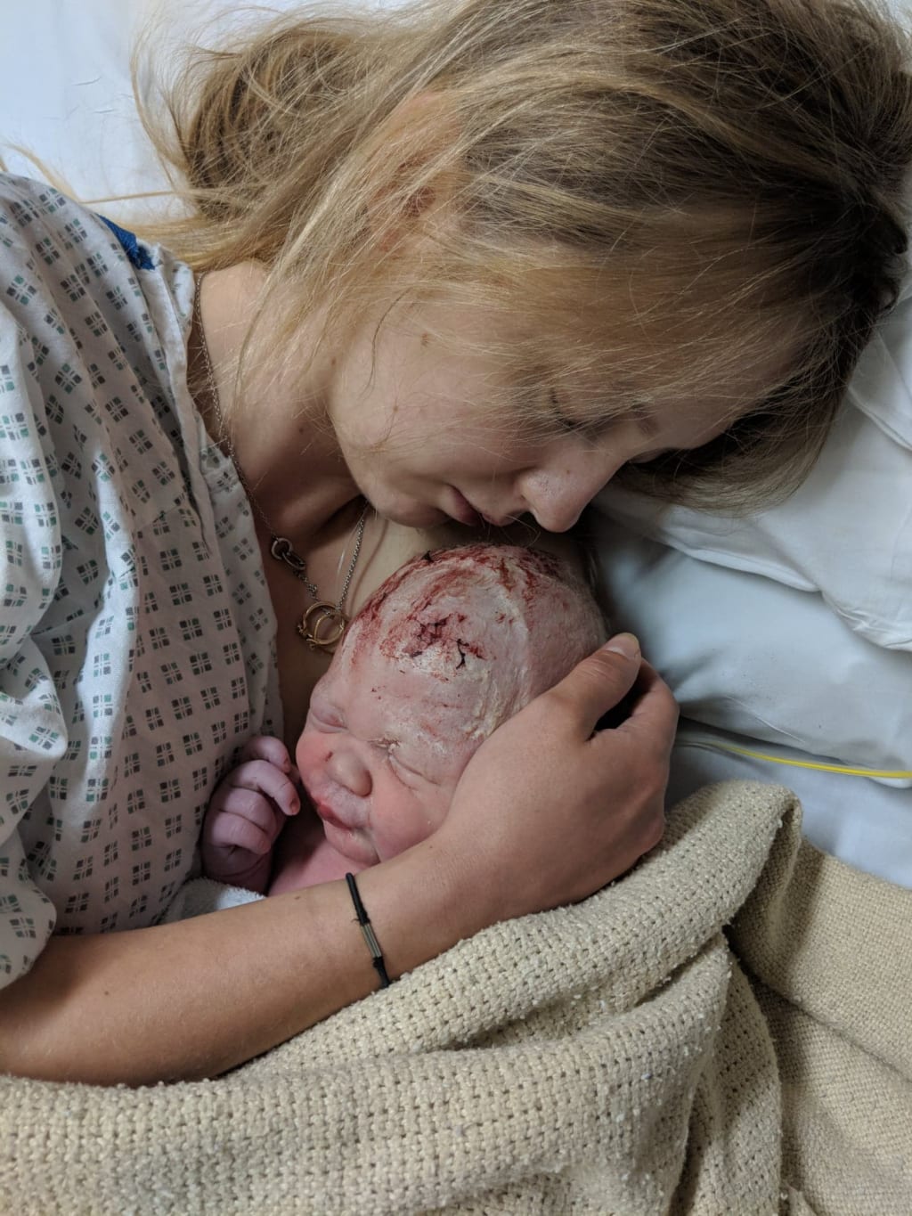 Postpartum Recovery Postpartum Recovery