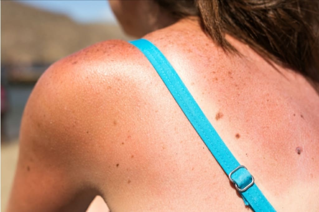 Sunscreen Enables the Patriarchy Sunscreen Enables the Patriarchy