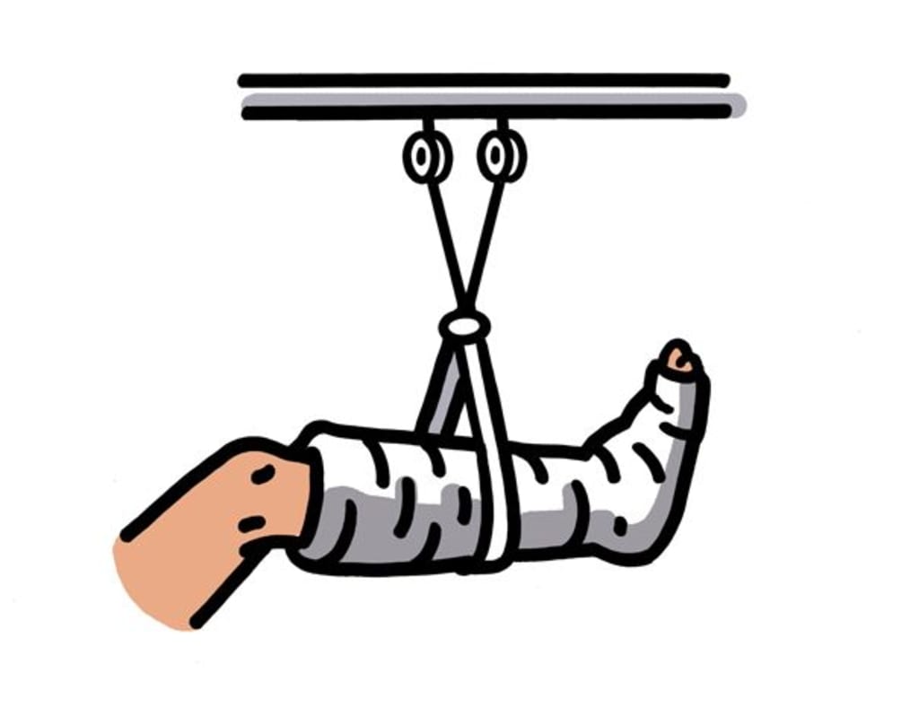 Sprained Ankle Sprained Ankle