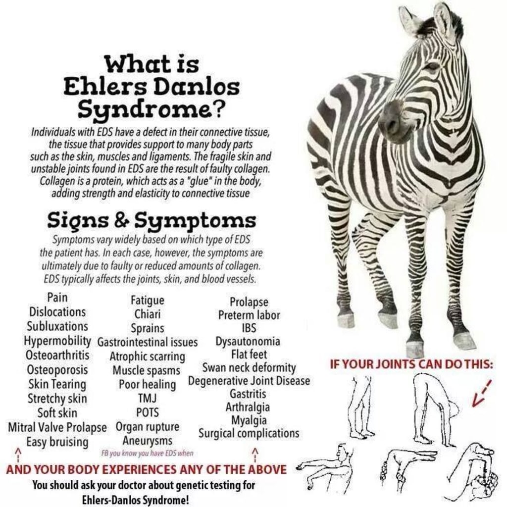 Ehlers danlos syndrome что это