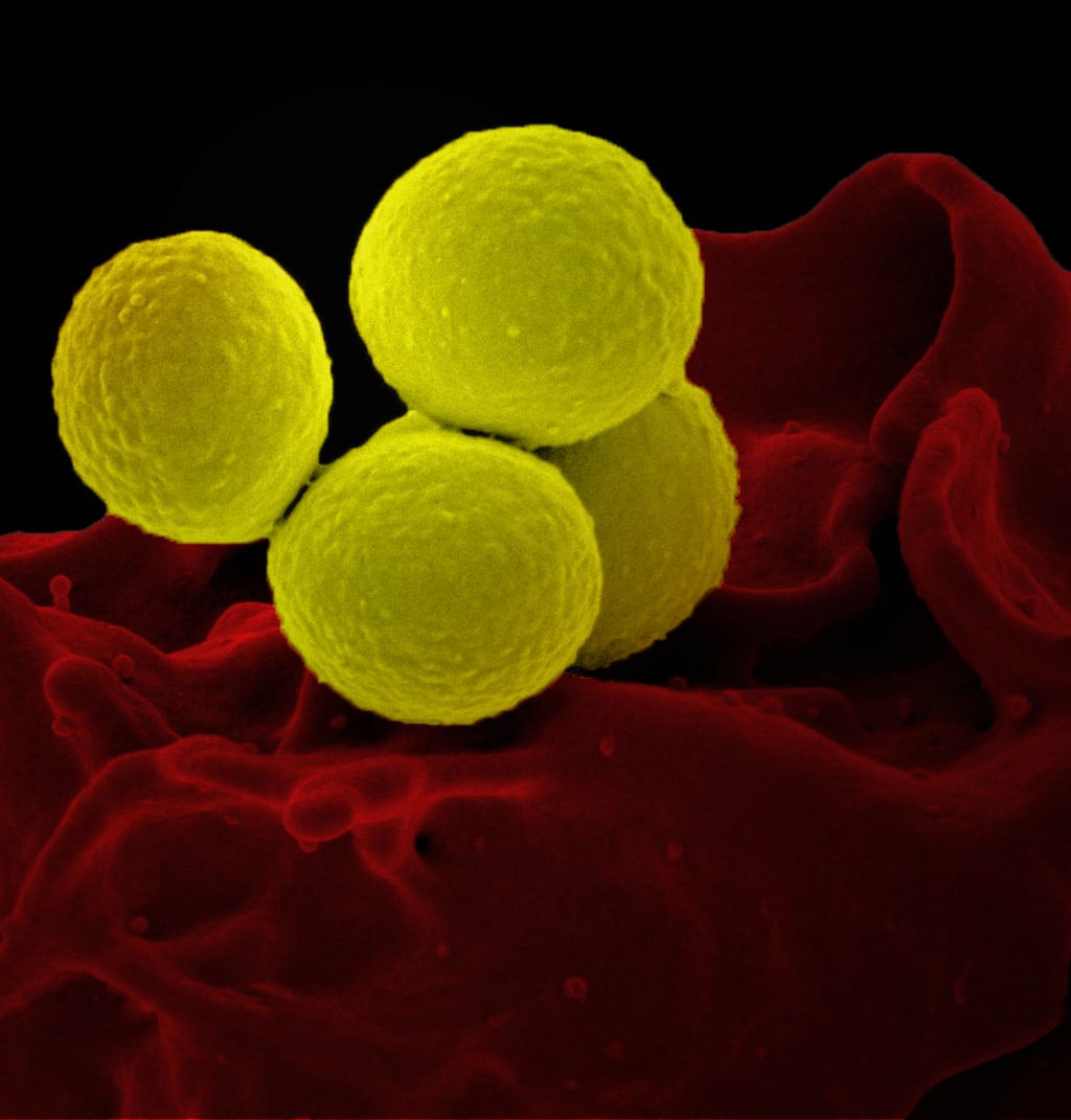 the-emergence-of-the-superbugs-futurism