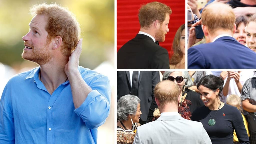 Prince Harry's Bald Spot Has Doubled in Size in Just One Year Prince Harry's Bald Spot Has Doubled in Size in Just One Year