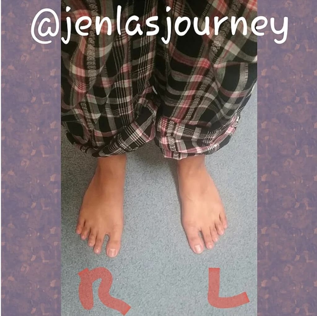 What to Do if You Have Flat Feet? What to Do if You Have Flat Feet?