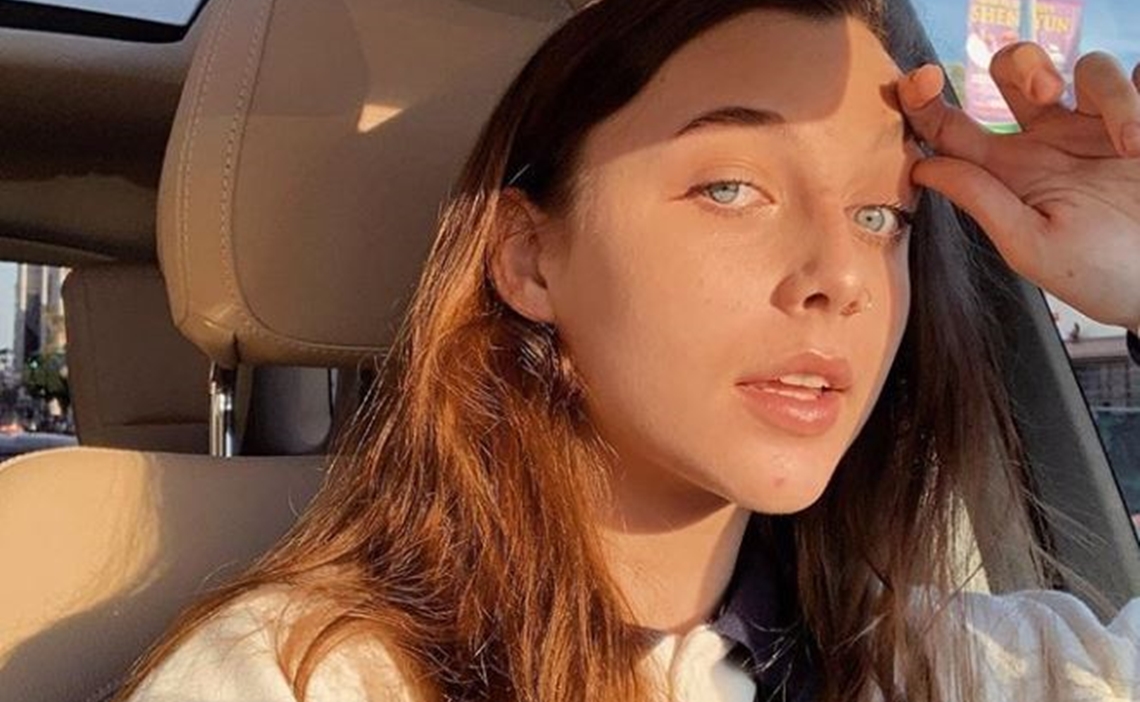 Emma Chamberlain on How to Treat Cracked Lips While on Accutane