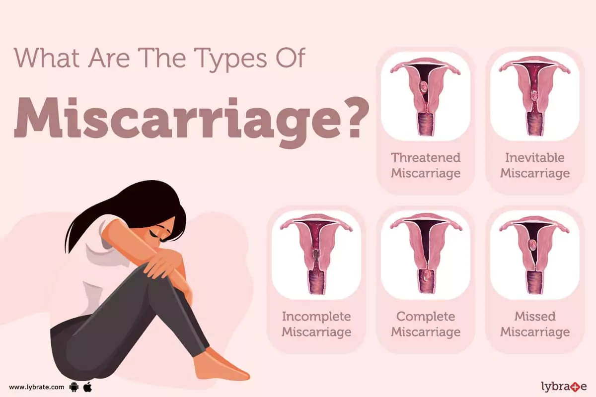 Miscarriage meaning