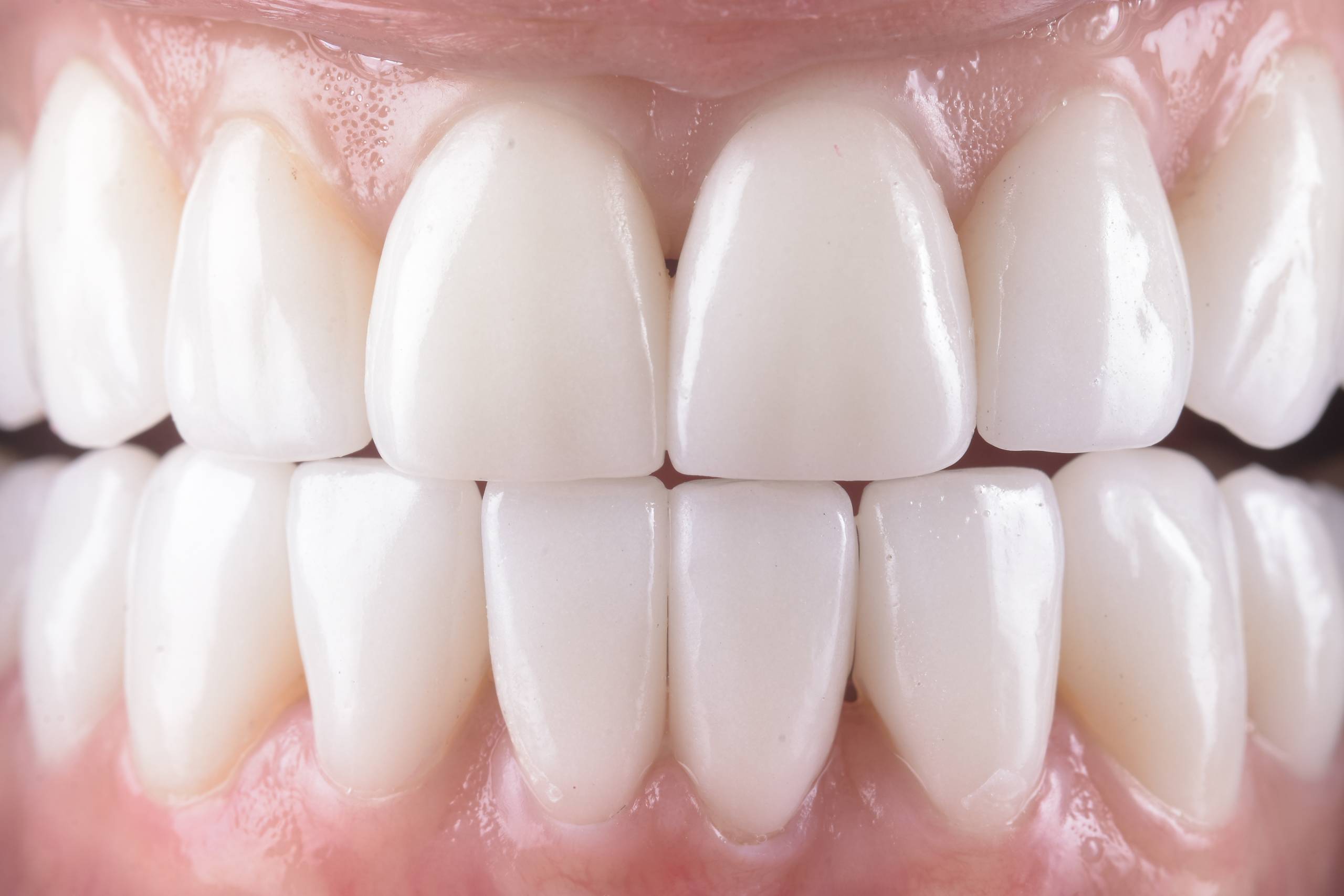 Normal Colour Teeth What Do Normal Healthy Teeth Look Like