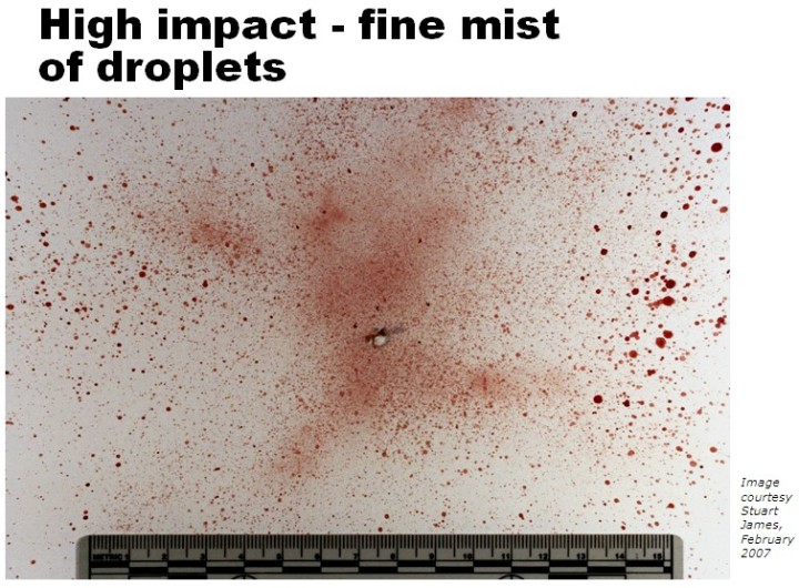 Bloodstain Patterns