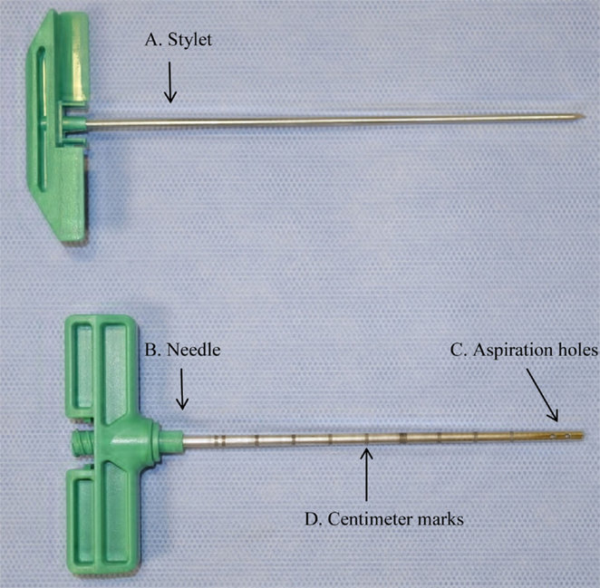 Needle used for bone marrow aspiration