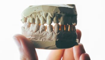 a hand holding a model of a human jaw