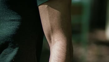 a close up of a person's arm