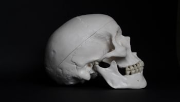 a side-view of a skull