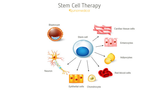 Stem Cell Therapy