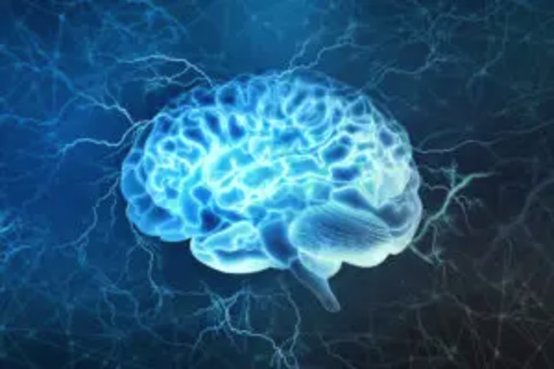 a brain with neurons firing representing vagus nerve stimulation for anxiety in san francisco 