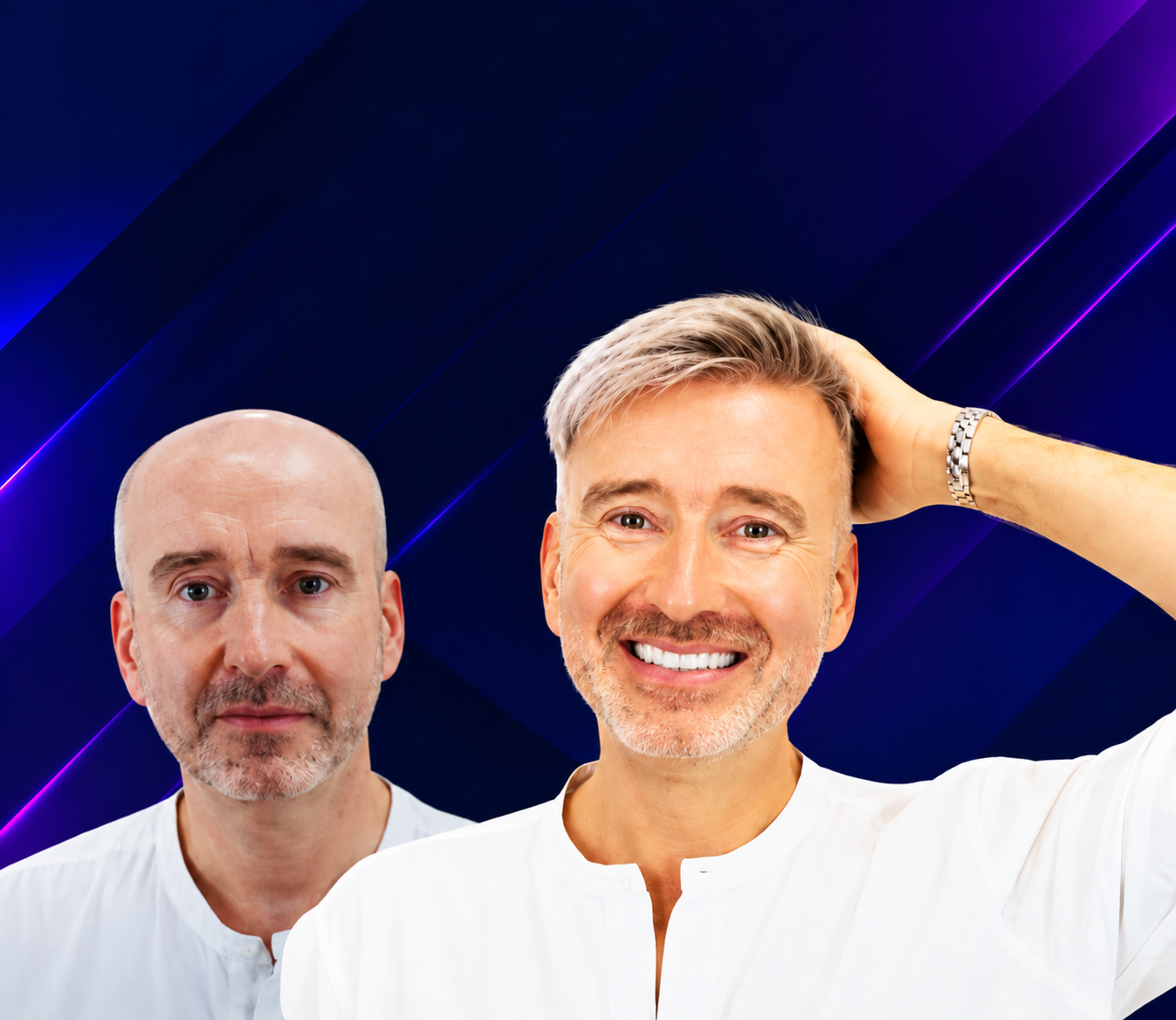 Prótesis capilar