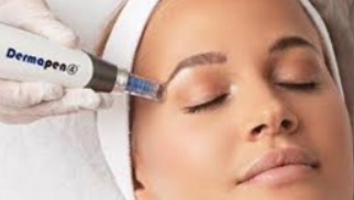 Tratamiento Dermapen en Toque Perfecto