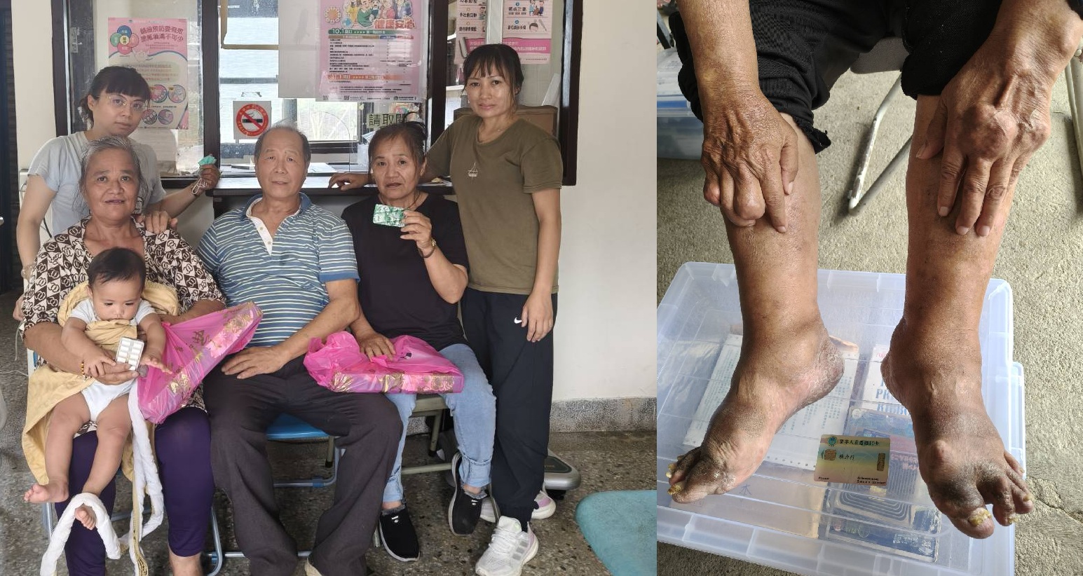 賴醫師協助部落婦女戒菸,自製檸檬汁及月餅相贈以資鼓勵。(右圖)原住民身體最痛的是痛風,賴醫師根據調查研究。(受訪者提通)