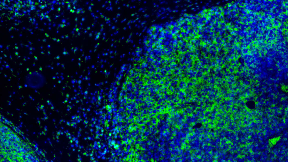 Inhibrx Achieves Progress on Challenging Immunotherapy Target