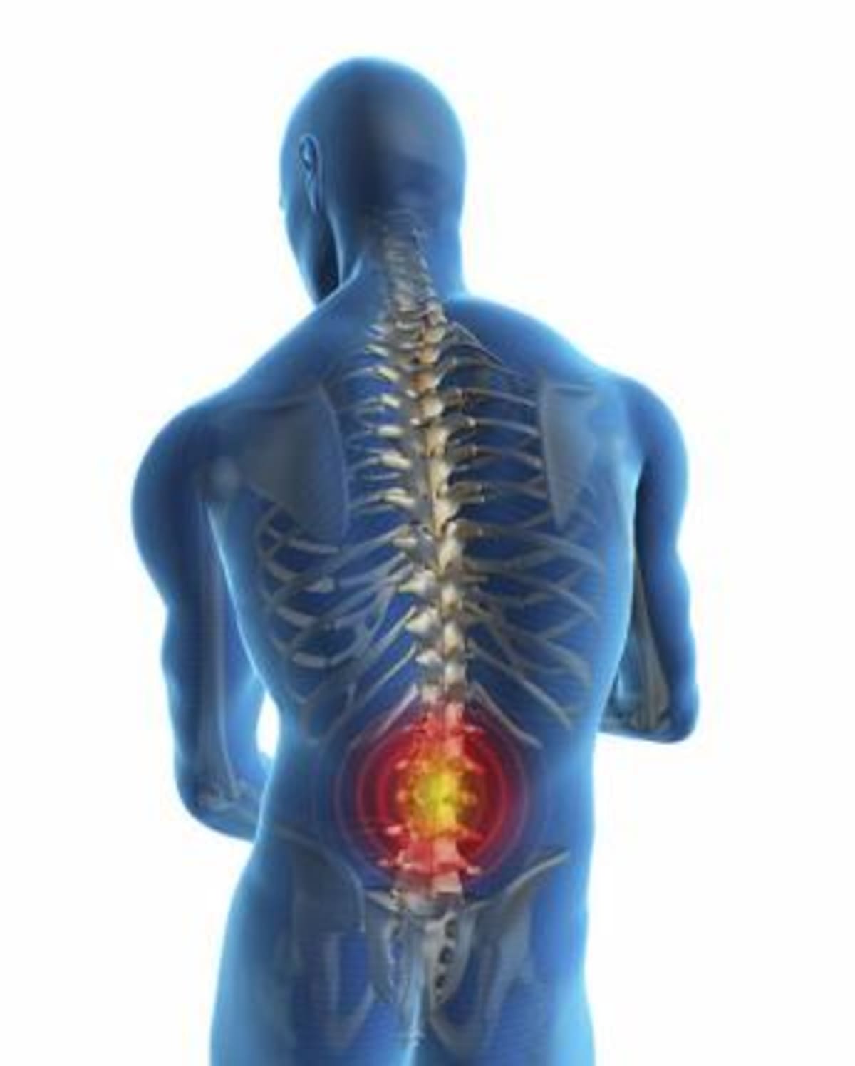 Denton Spine Surgeon Addresses Causes and Prevention of Common Back and Neck Pain