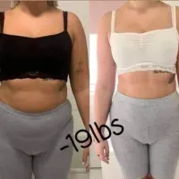Gastric Band Slim Body