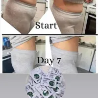 Gastric Band Slim Body