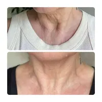 Paprika And Chilli Gel