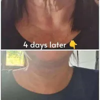 Paprika And Chilli Gel