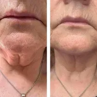 Paprika And Chilli Gel