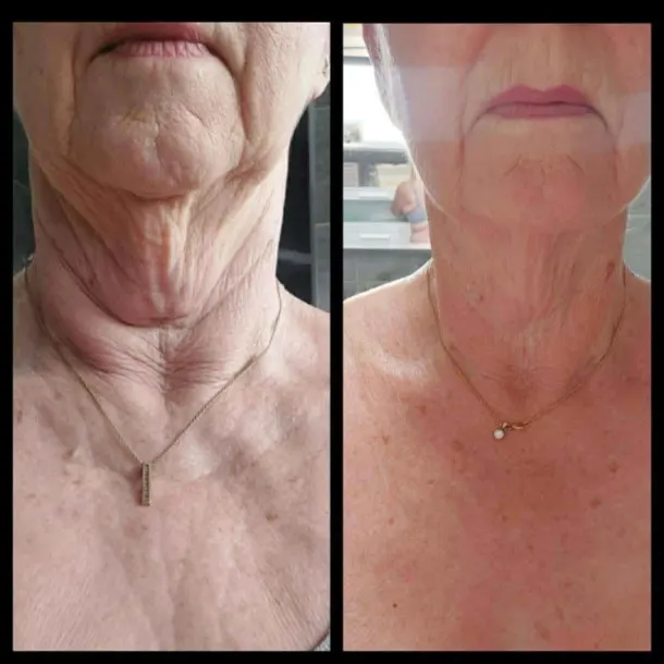 Paprika And Chilli Gel