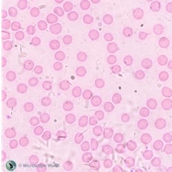 Activity 10: Blob Analysis