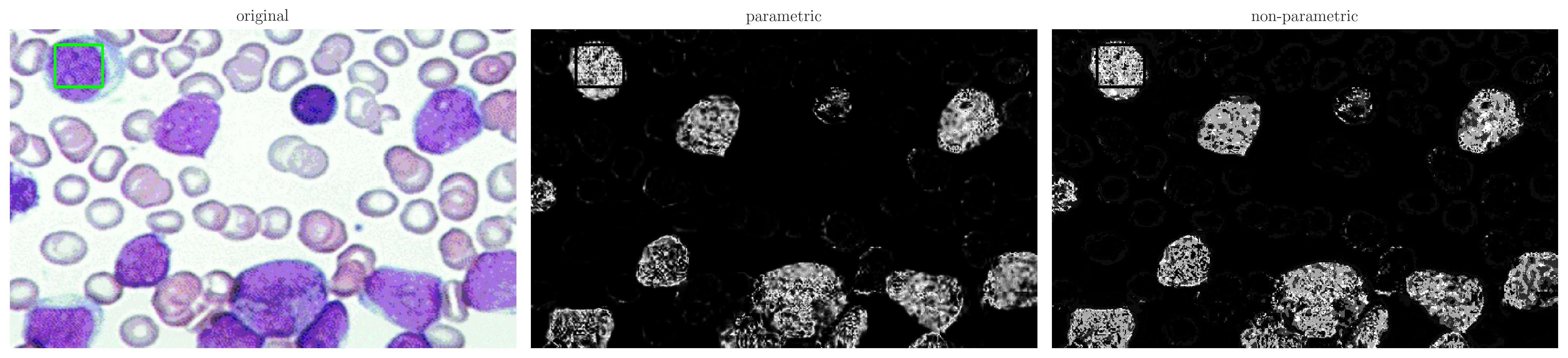 Figure 14: Healthy and cancerous red blood cells (left) parametric output (middle) and non-parametric output (right). The specific ROI is the bright green box outlining a portion of a giemsa-stained cancerous cell on the top left corner. Notice that both methods perform similarly and manage to capture only the stained cells.