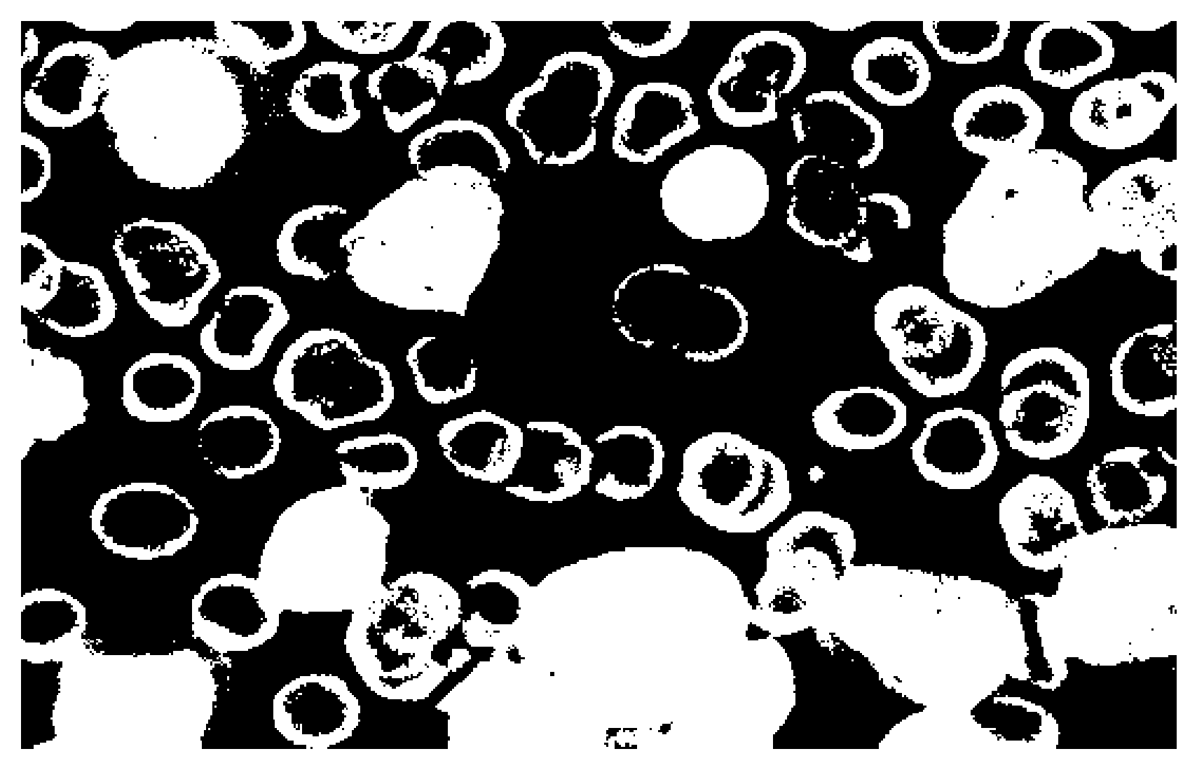 Figure 15: Cancer cell segmentation via Otsu's method. At first glance, this does method does not seem to be appropriate as it segments all the cells. However, according to [1], healthy RBCs can be characterized as hollow, torus-like shapes when they are Otsu-thresholded; if a significant amount of the RBC's nucleus is segmented, that could indicate something wrong with the cell. In the image, we can see that the cancerous cells are completely segmented, so we can say from this interpretation that Otsu's method is a valid segmentation algorithm for applications such as this.