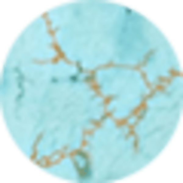 Variegated Turquoise Magnesite