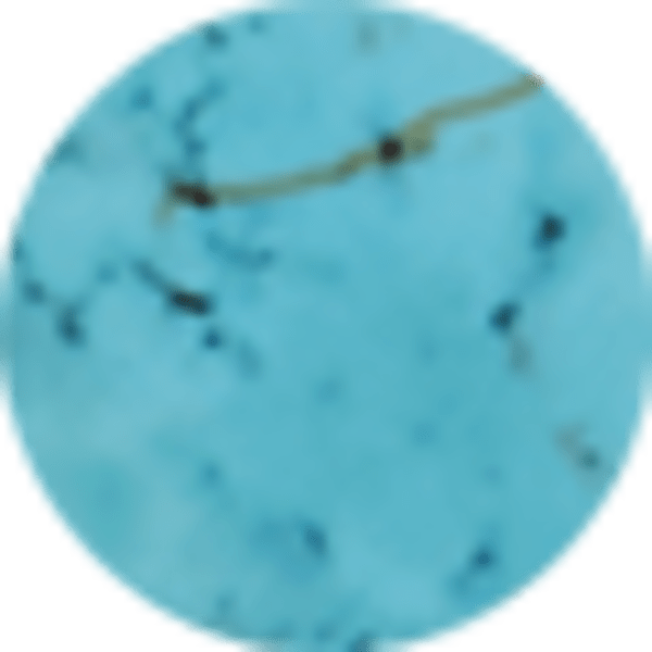 Variegated Turquoise Magnesite