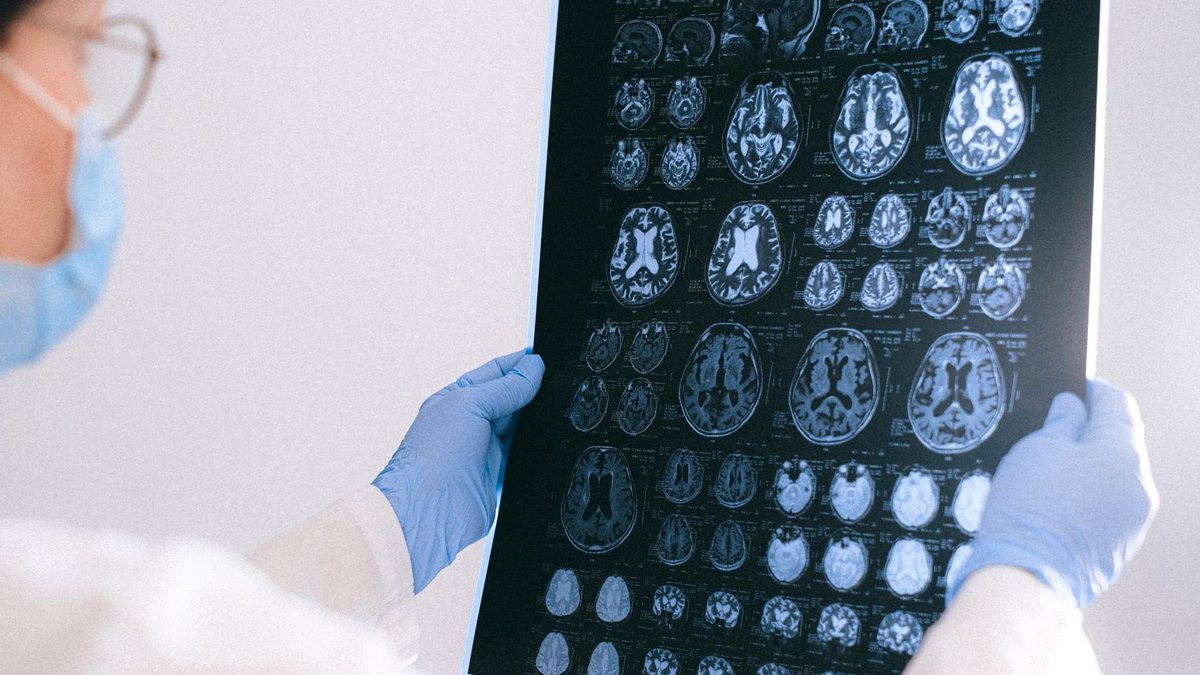 Sugar fuelled human brain growth Sugar fuelled human brain growth - brain evolution