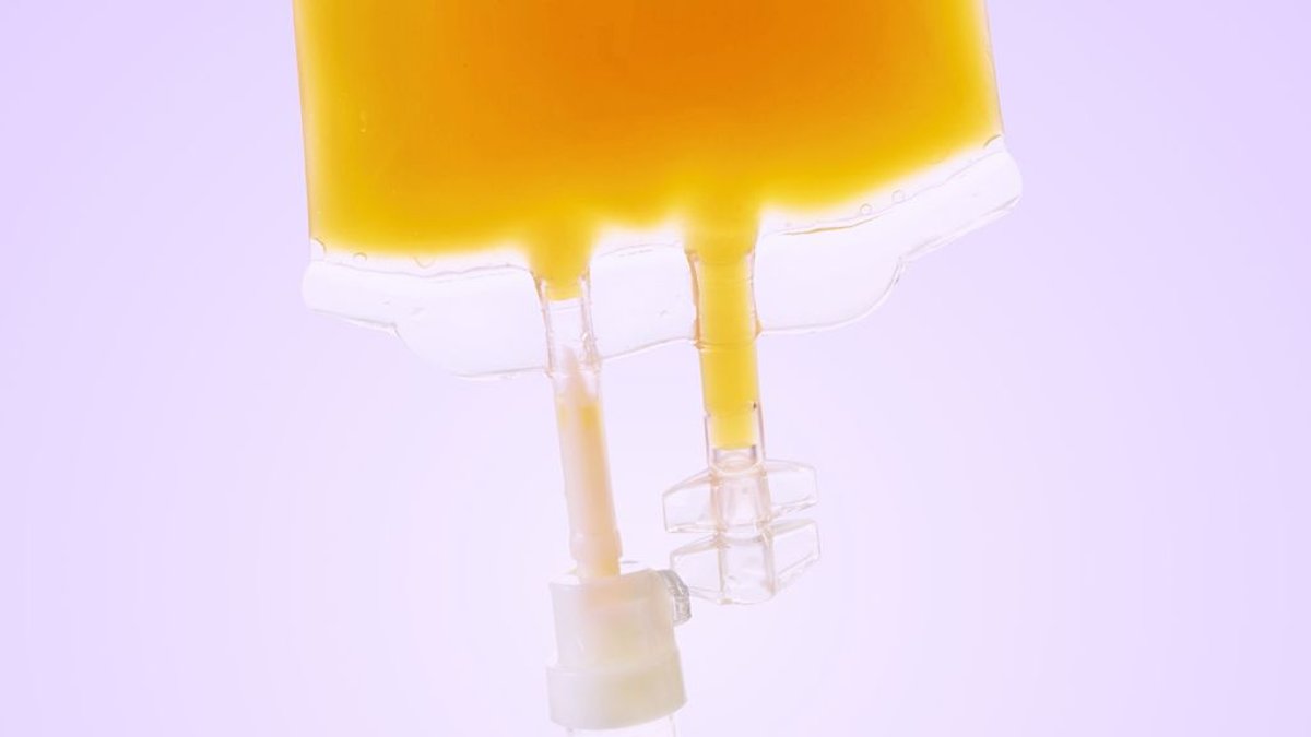 Plasma Replacement May Slow Aging Process Plasma Replacement May Slow Aging Process - plasma replacement