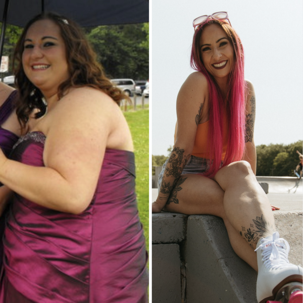 BodyImage