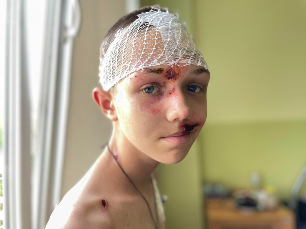 A patient in Ukraine.